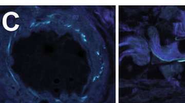 Las partes en azul oscuro son haces de colágeno fibrilar. En la imagen de la derecha se ven las fibras de elastina en negro y las estructuras de colágeno en rosa.