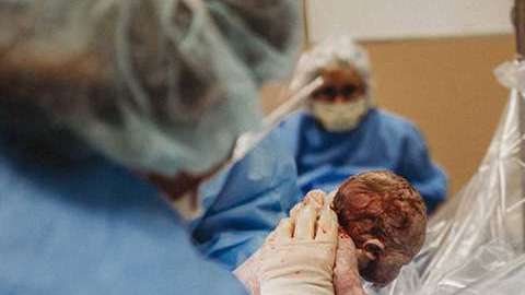 2arix-mom-delivers-own-baby-c-section-4