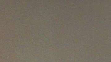 Para los médicos es sorprendente que Hawking haya sobrevivido más de 50 años con ELA.