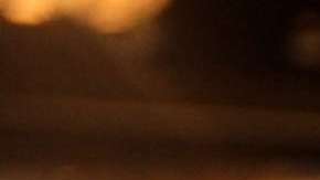 Saúl "Canelo" Álvarez no podría subirse al ring desde seis meses hasta un año