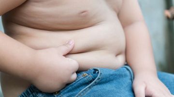 Cada día va en aumento la obesidad infantil.