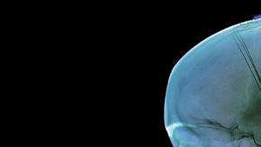 SCIENCE PHOTO LIBRARY