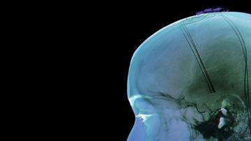 SCIENCE PHOTO LIBRARY