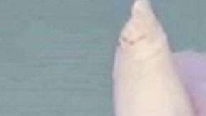 Las numerosas operaciones a las que fue sometida Pollyanna Hope no le impidieron cumplir su sueño de ser bailarina.