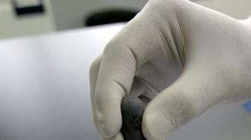 EEUU registró 221 casos de "bacterias pesadilla" en 2017.