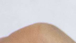 La diabetes también puede causar enfermedades cardíacas, derrames cerebrales y la necesidad de amputar un miembro.