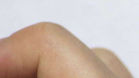 La diabetes también puede causar enfermedades cardíacas, derrames cerebrales y la necesidad de amputar un miembro.