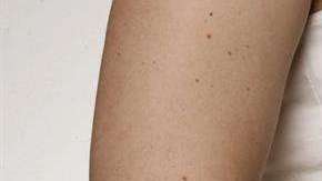 La mujer se encontraba en el octavo mes de gestación.