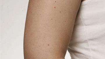 La mujer se encontraba en el octavo mes de gestación.