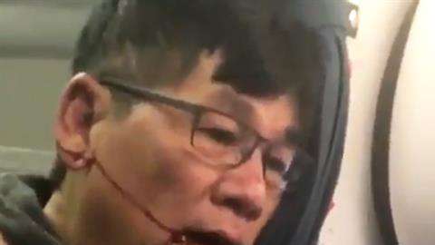 David Dao, el pasajero de United Airlines que terminó con la cara ensangrentada luego de que lo expulsaran de su asiento