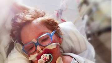 El pequeño Gerrit tiene una enfermedad rara, llamada  enanismo microcefálico osteodisplásico primordial, y está siendo tratado en alemania