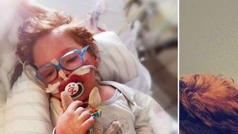 El pequeño Gerrit tiene una enfermedad rara, llamada  enanismo microcefálico osteodisplásico primordial, y está siendo tratado en alemania