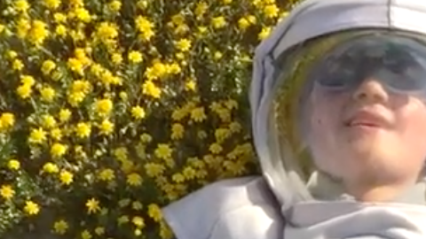 Oliver es un pequeño que tiene una rara condición en la piel, una alergia severa al sol.