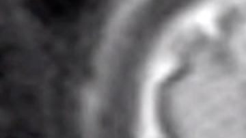 Radiografía muestra esta imagen del bebé.