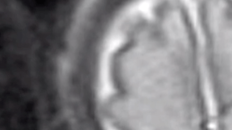 Radiografía muestra esta imagen del bebé.