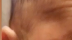Este bebé nació sin ojos, pero lucha por tener la mejor vida posible.