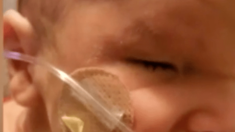 Este bebé nació sin ojos, pero lucha por tener la mejor vida posible.