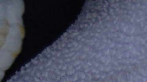 El sarampión es una enfermedad contagiosa.