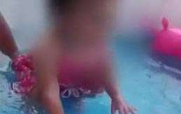 La bebé presenta quemaduras en un 10 % de su cuerpo.