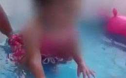 La bebé presenta quemaduras en un 10 % de su cuerpo.