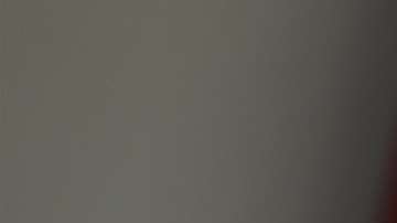 La Primera Dama fue intervenida quirúrgicamente este lunes.