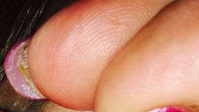 Esta mujer descubrió las consecuencias de no desmaquillarse apropiadamente.