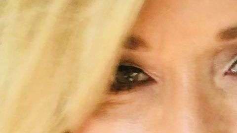 Theresa Lynch estuvo a punto de perder la vista por no desmaquillarse.