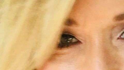 Theresa Lynch estuvo a punto de perder la vista por no desmaquillarse.