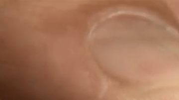 El medicamento Liraglutida es más conocido por el nombre de su marca: Saxenda.