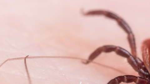 Descubre cuáles son su síntomas y cómo puedes prevenir dicha enfermedad.