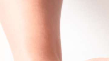 Según los expertos, la grasa abdominal es la más peligrosa.