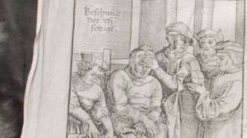 La trepanación se practica desde la prehistoria.