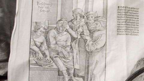 La trepanación se practica desde la prehistoria.
