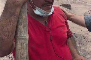 Hugo López, quien vive en El Rodeo, perdió su casa .