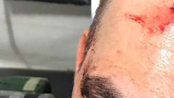 José Manuel Figueroa se accidenta