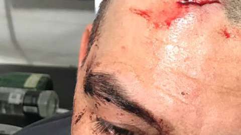 José Manuel Figueroa se accidenta