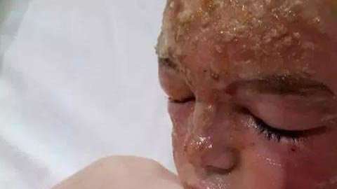 La familia levantó una campaña en Go Fund Me para costear los gastos médicos del tratamiento de Owen.