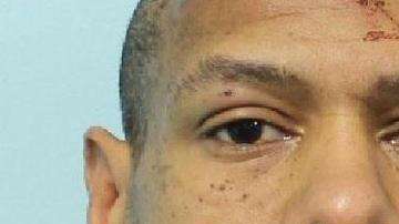 Weldon (47) fue arrestado después de chocar una patrulla policial