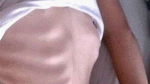 Impactante: el antes y el después de Camila.