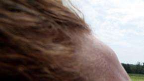 El ciclista australiano Simon Clarke fue uno de los afectados por el gas pimienta