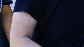 El herido dejó manchas de sangre en la acera de la embajada