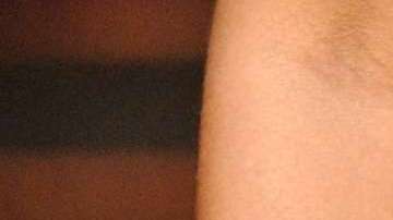 La FDA advirtió de los peligros de los tratamientos con láser vaginal.