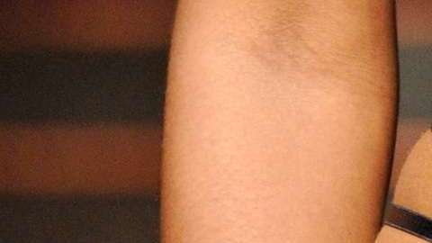 La FDA advirtió de los peligros de los tratamientos con láser vaginal.