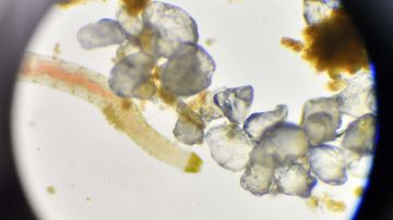 Un gusano marino en el microscopio.