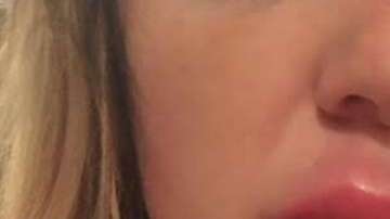 Jessica Bennett  sufrió de inflamación por una semana.