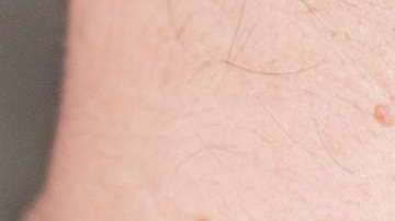 Mucho cuidado con las protuberancias que aparecen de momento.