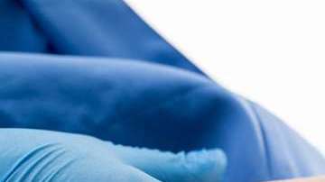 Las várices pueden derivar en algo peligroso.