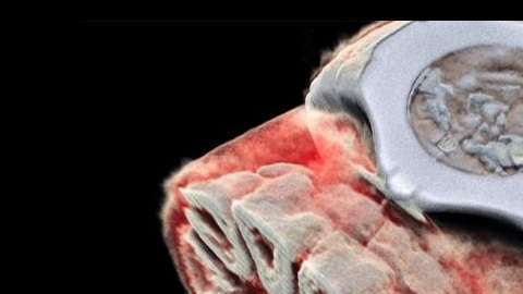 El escáner capta partículas subatómicas.