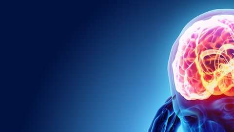 Las migrañas afectan a una de cada 5 mujeres.