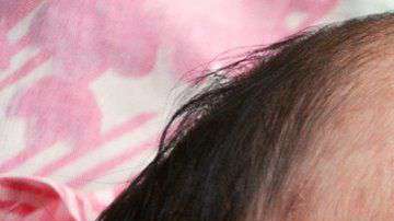 El sarampión se contagia con facilidad entre individuos susceptibles.